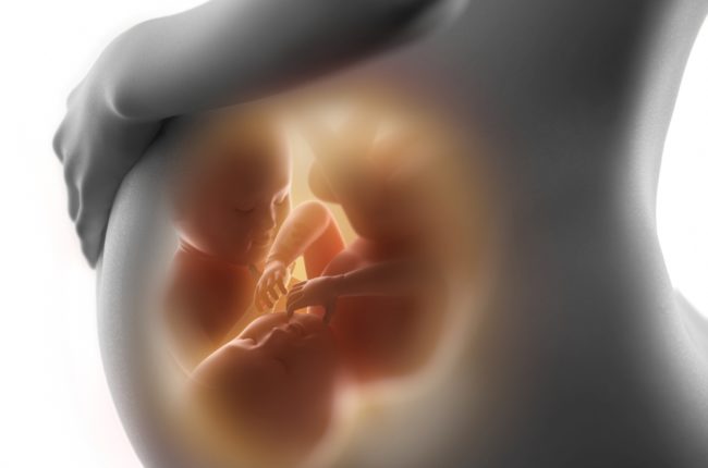 grossesse gemellaire